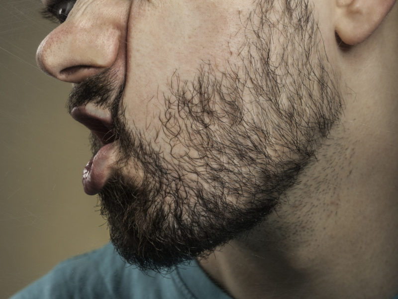 Man with face smashed against glass