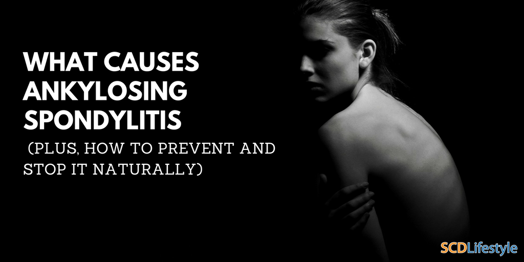 What Causes Ankylosing Spondylitis (Plus, How to Prevent and Stop It Naturally)